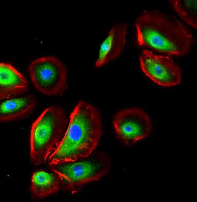 NK1R Antibody - BSA Free