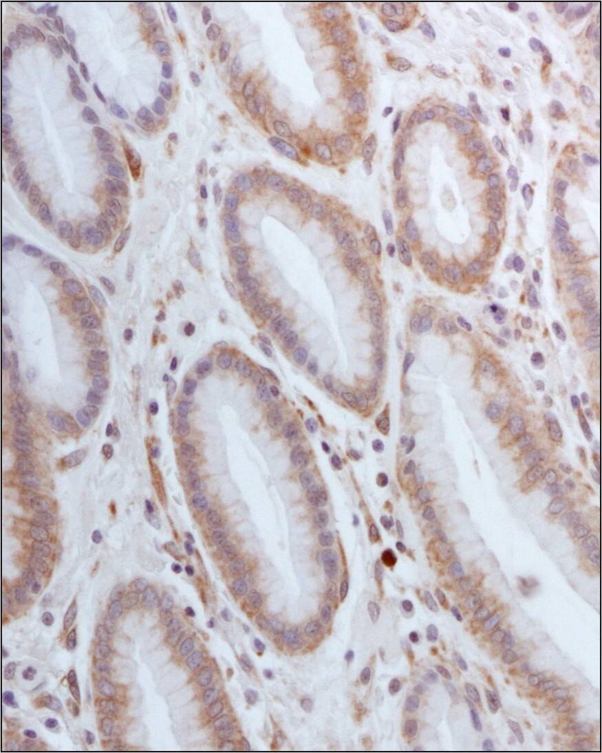xCT Antibody - BSA Free Immunohistochemistry-Paraffin: xCT Antibody [NB300-317]