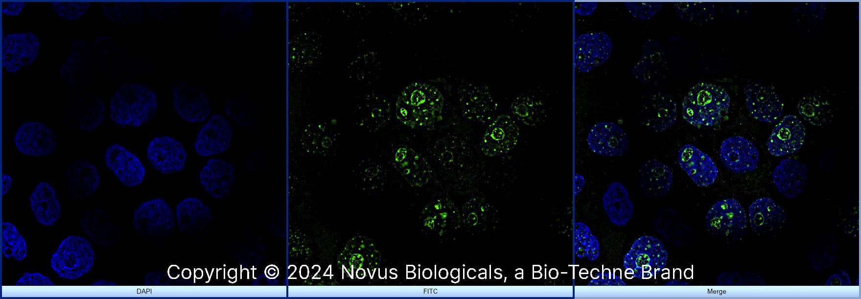 Ki67/MKI67 Antibody - BSA Free (NB500-170) by Novus, Part of