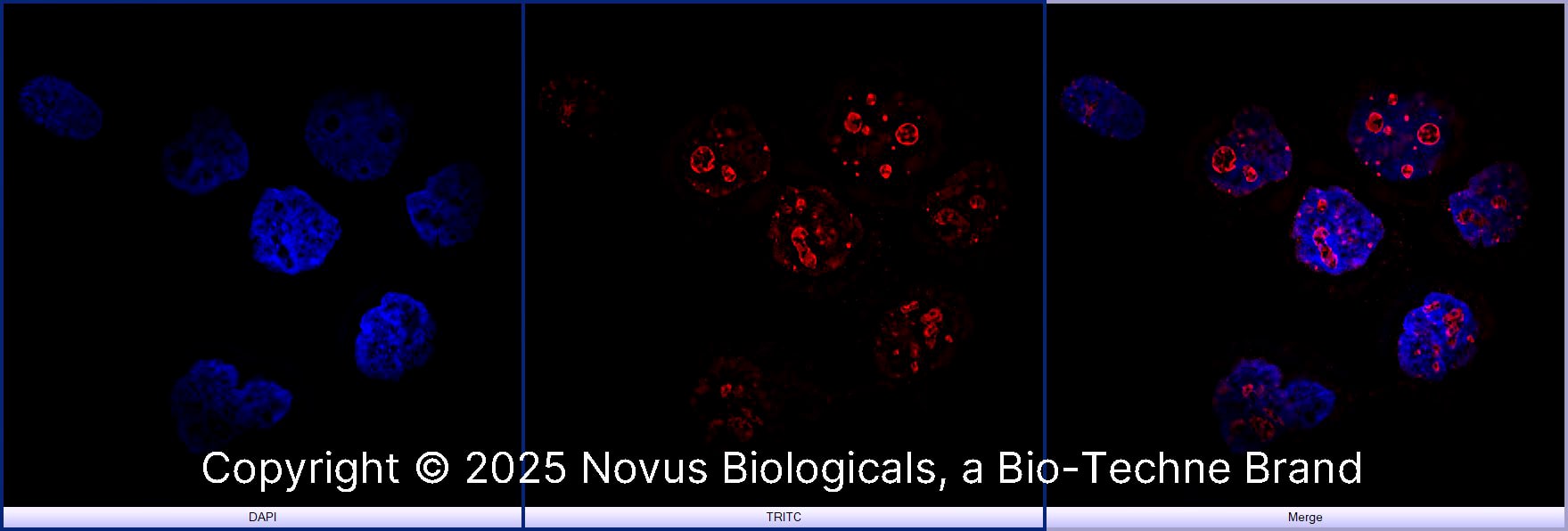 Ki67/MKI67 Antibody - BSA Free (NB500-170) by Novus, Part of
