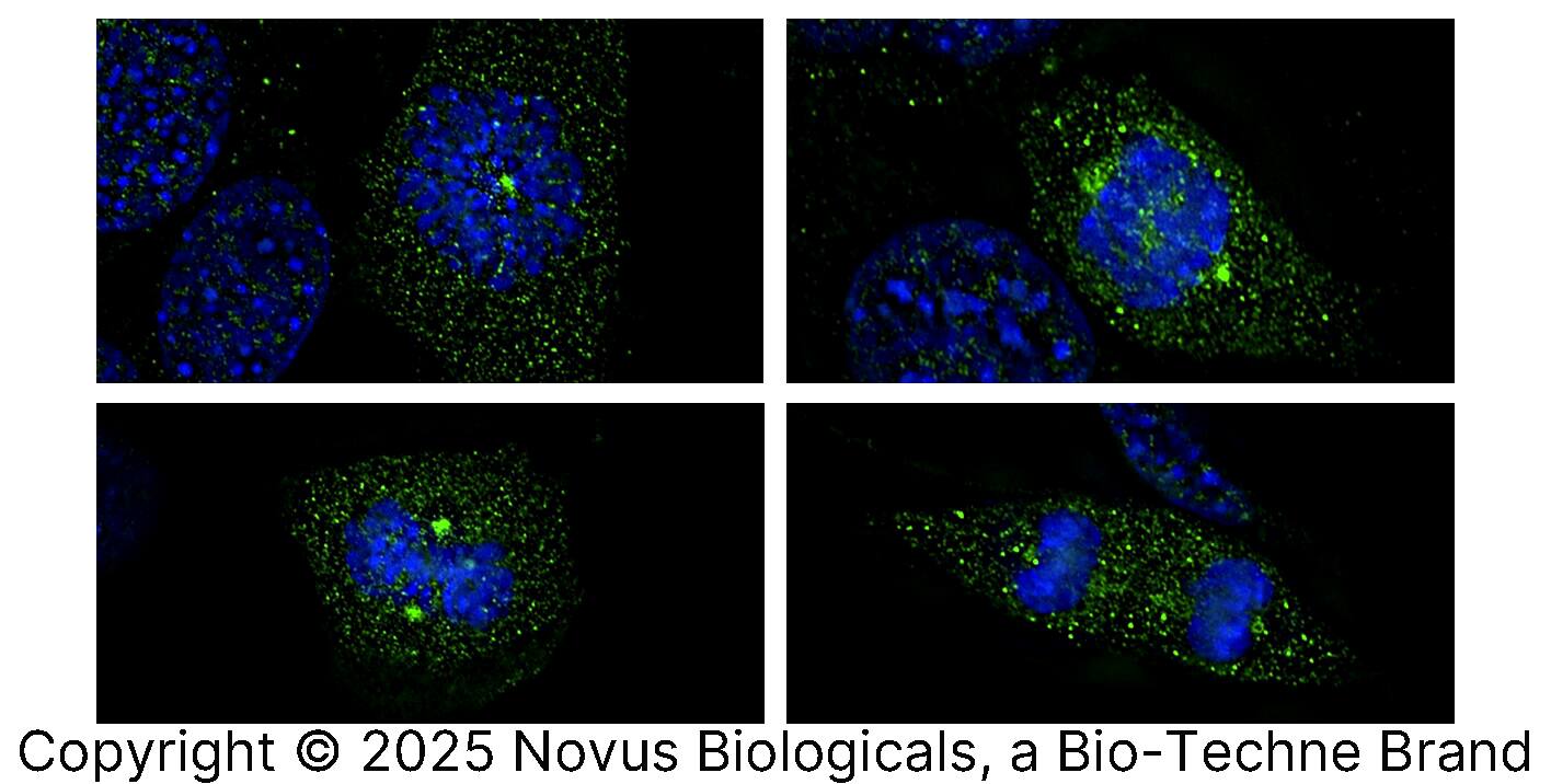 Survivin [p Thr34] Antibody - BSA Free