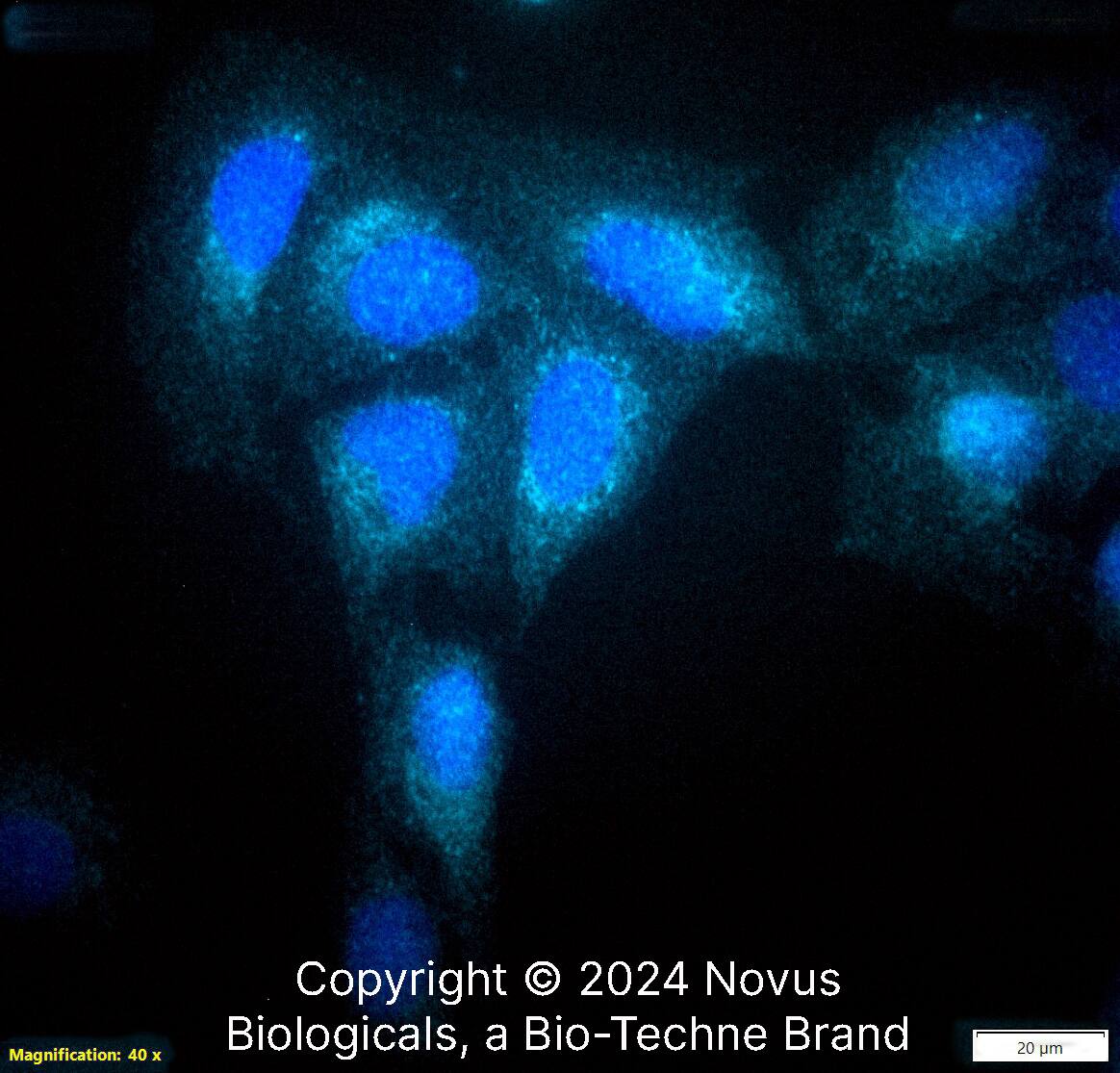Calreticulin Antibody - BSA Free