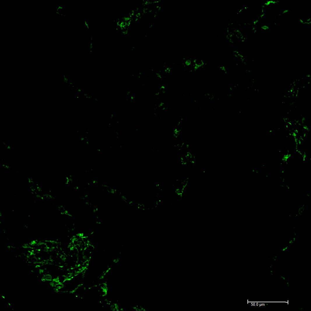 CD31/PECAM-1 Antibody (JC/70A) - BSA Free