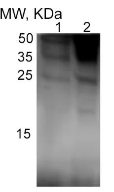 IL-1 beta/IL-1F2 Antibody