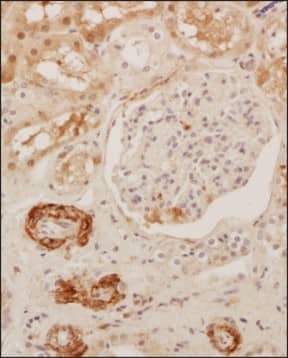 SUCNR1/GPR91 Antibody - BSA Free Immunohistochemistry-Paraffin: SUCNR1/GPR91 Antibody - BSA Free [NBP1-00861]