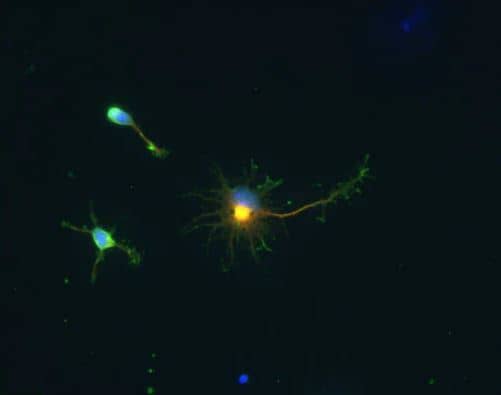 GAD1/GAD67 Antibody Immunocytochemistry/Immunofluorescence: GAD1/GAD67 Antibody [NBP1-02161]