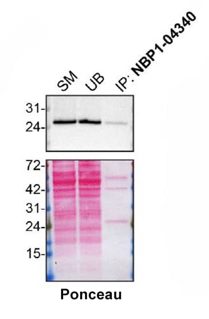Rab5a Antibody (3A4) - BSA Free