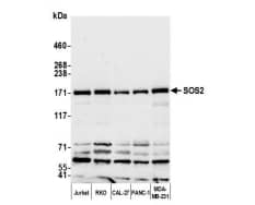 SOS2 Antibody - BSA Free