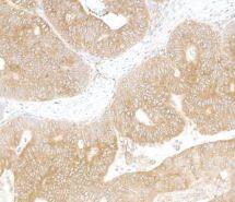 LARP1 Antibody