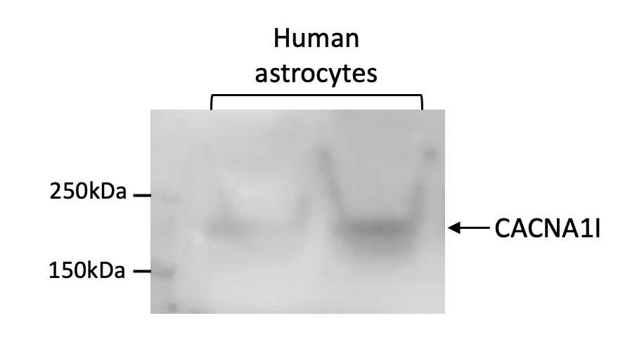 CACNA1I Antibody - Azide and BSA Free