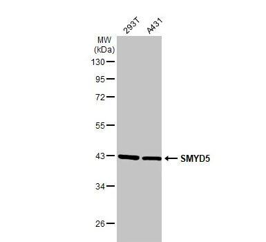 SMYD5 Antibody