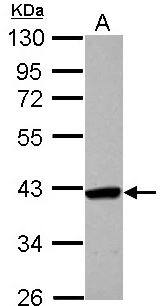 SMYD5 Antibody