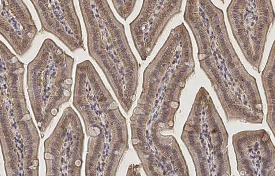 Inorganic Pyrophosphatase/PPA1 Antibody