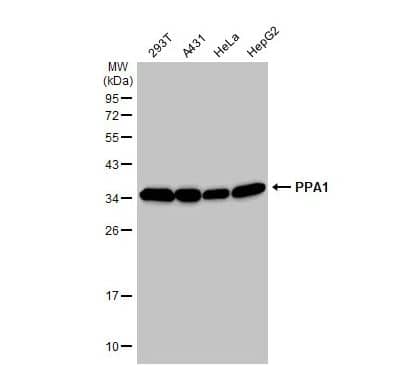 Inorganic Pyrophosphatase/PPA1 Antibody