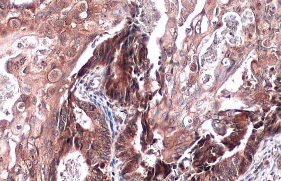 ST3 beta-Gal alpha-2,3-Sialyltransferase 1/ST3GAL1/SIAT4A Antibody