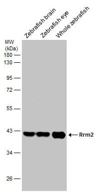 RRM2 Antibody