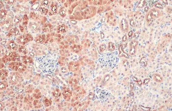 Cystathionase Antibody