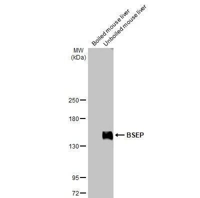 ABCB11 Antibody