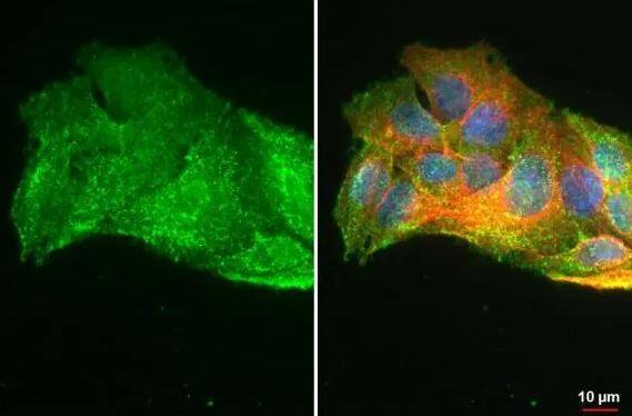 Glutathione Peroxidase 2/GPX2 Antibody