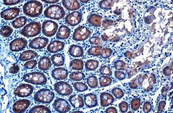 Glutathione Peroxidase 2/GPX2 Antibody