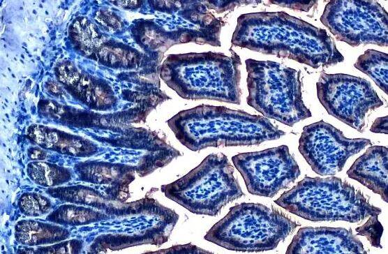 Glutathione Peroxidase 2/GPX2 Antibody