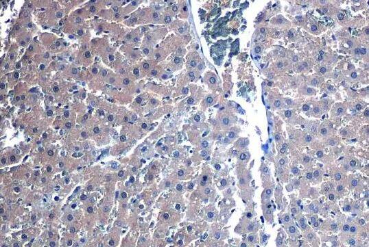 Glutathione Peroxidase 2/GPX2 Antibody