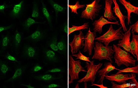 SNRPB Antibody