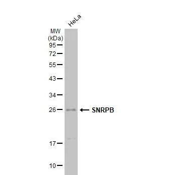 SNRPB Antibody