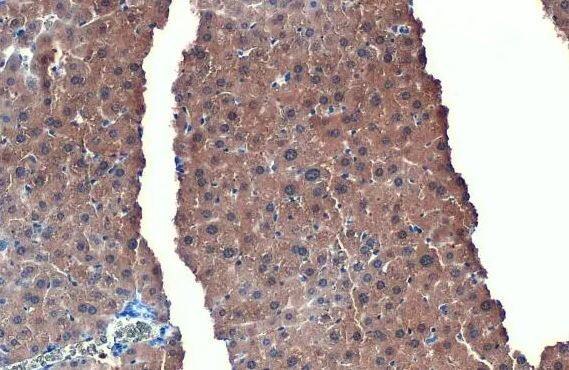 FABP1/L-FABP Antibody