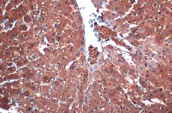 FABP1/L-FABP Antibody