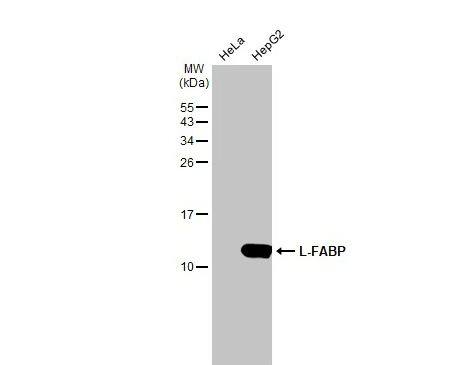 FABP1/L-FABP Antibody