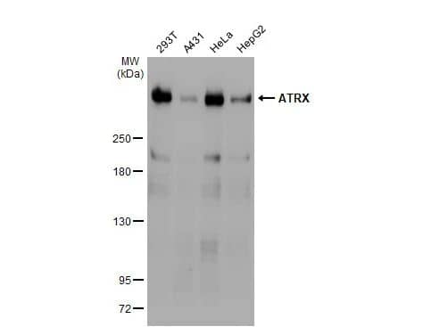 ATRX Antibody