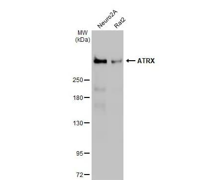 ATRX Antibody