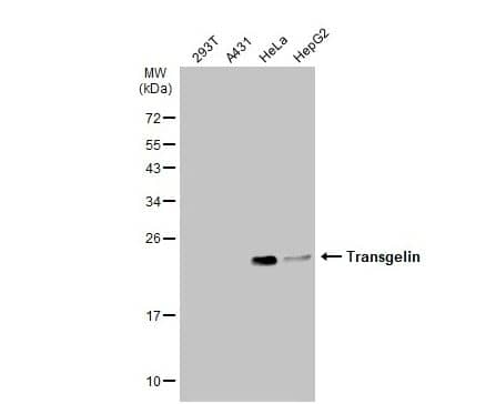 Transgelin/TAGLN/SM22 alpha Antibody