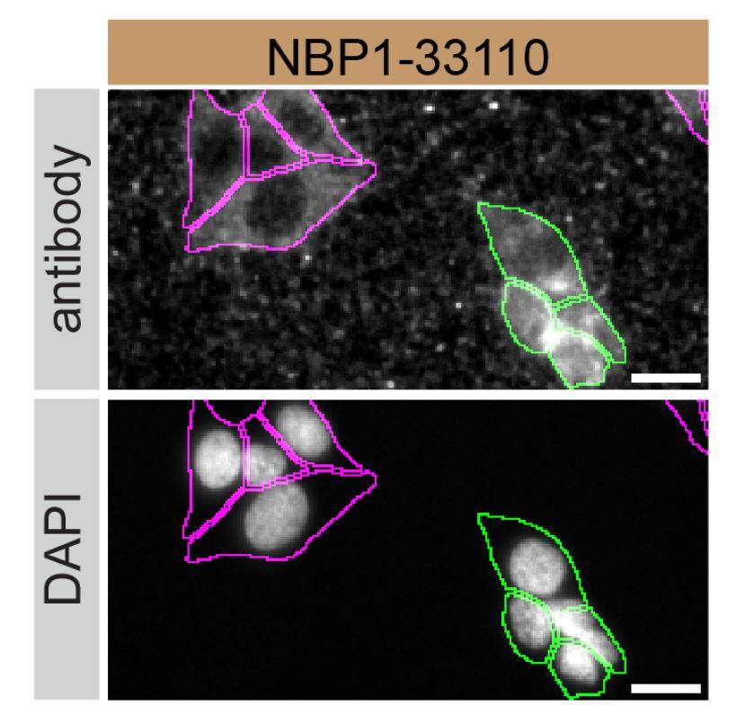 RAB6A Antibody