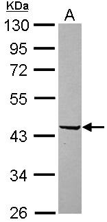 SerpinB2 Antibody