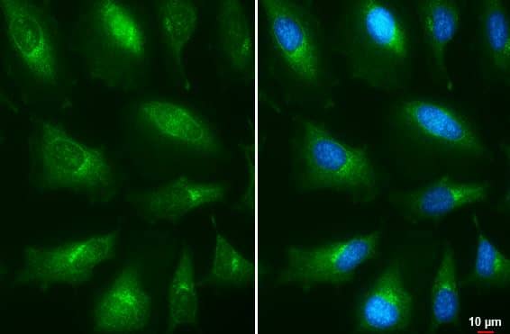 Presenilin-1 Antibody