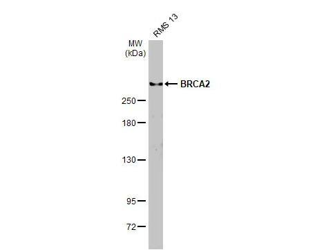 BRCA2 Antibody (5F6)