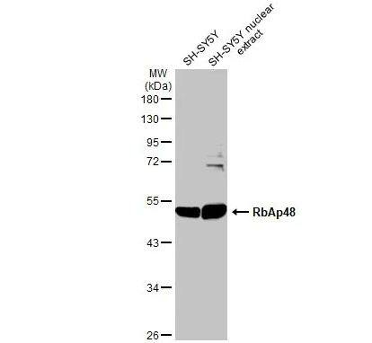 RBBP4/RbAp48 Antibody (13D10)
