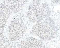 HJURP Antibody [NBP1-47287]