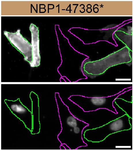 CD44 Antibody (8E2F3) - BSA Free CD44 Specificity is Shown by Immunocytochemistry in Knockout Cell Line.