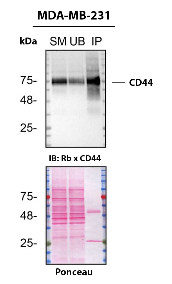 CD44 Antibody (8E2F3) - BSA Free Detection of CD44 by Immunoprecipitation.