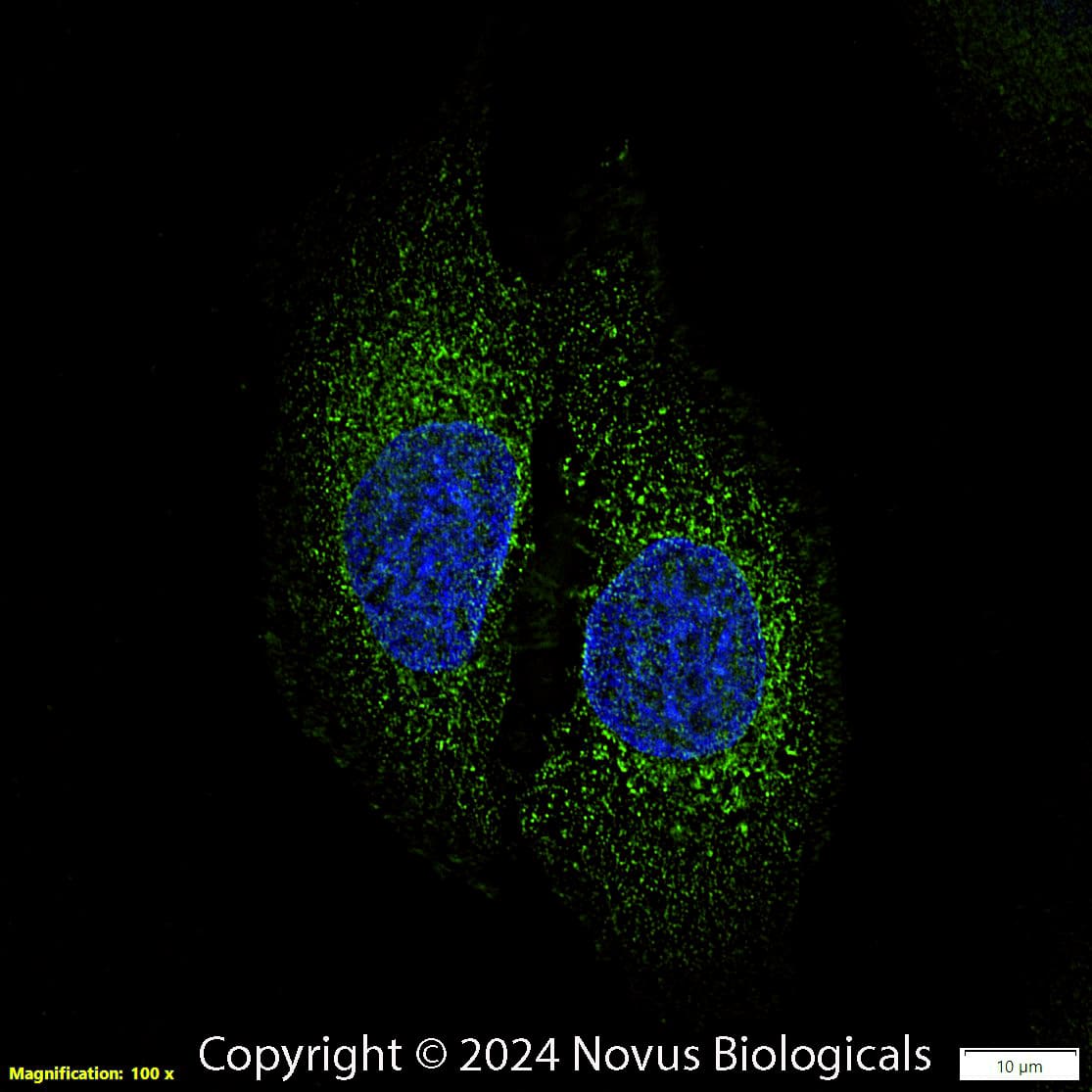 Calreticulin Antibody (1G6A7) - BSA Free