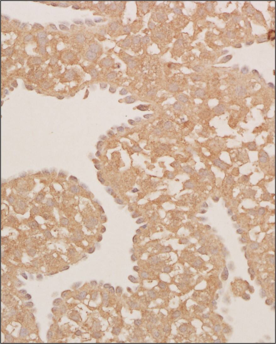 Calreticulin Antibody (1G6A7) - BSA Free Immunohistochemistry-Paraffin: Calreticulin Antibody (1G6A7) - BSA Free [NBP1-47518]