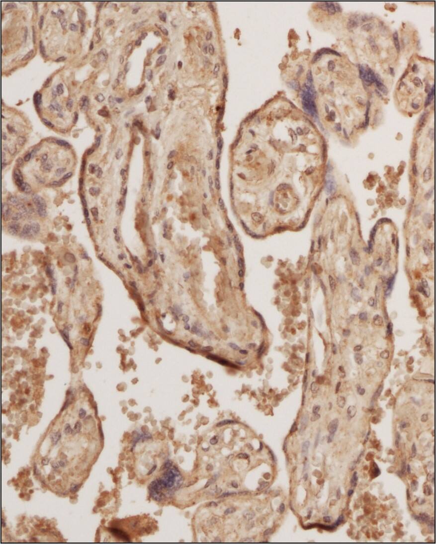 Calreticulin Antibody (1G6A7) - BSA Free Immunohistochemistry-Paraffin: Calreticulin Antibody (1G6A7) - BSA Free [NBP1-47518]