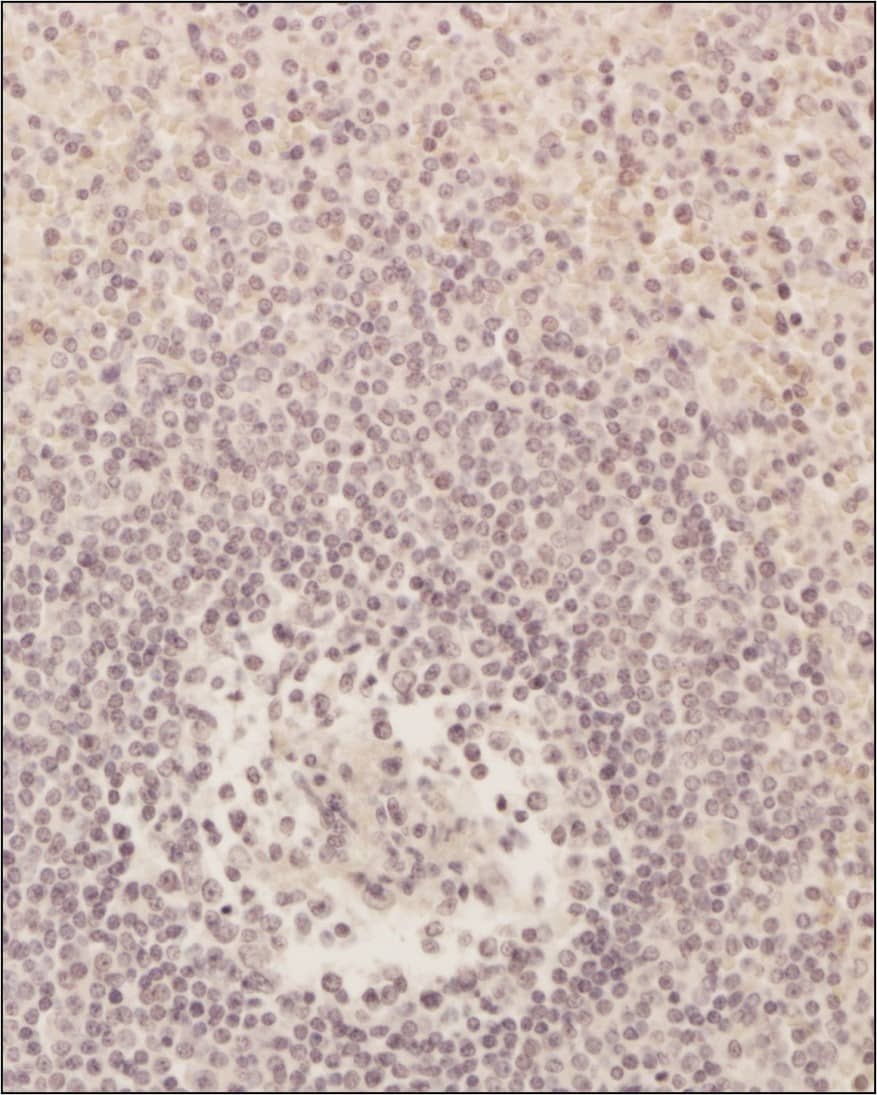 CD8 Antibody (53-6.7) - BSA Free Immunohistochemistry-Paraffin: CD8 Antibody (53-6.7) - BSA Free [NBP1-49045]