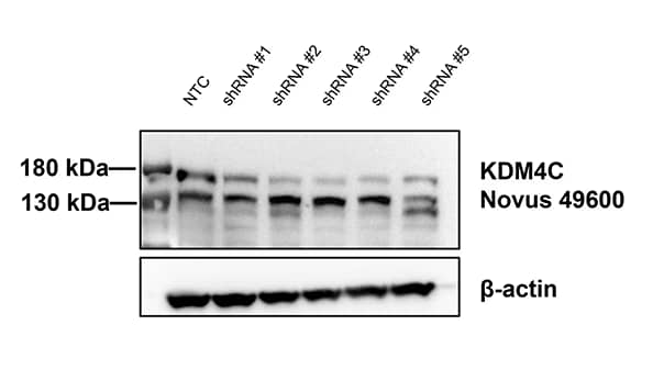 Lysine (K)-specific Demethylase 4C/KDM4C/JMJD2C Antibody - BSA Free