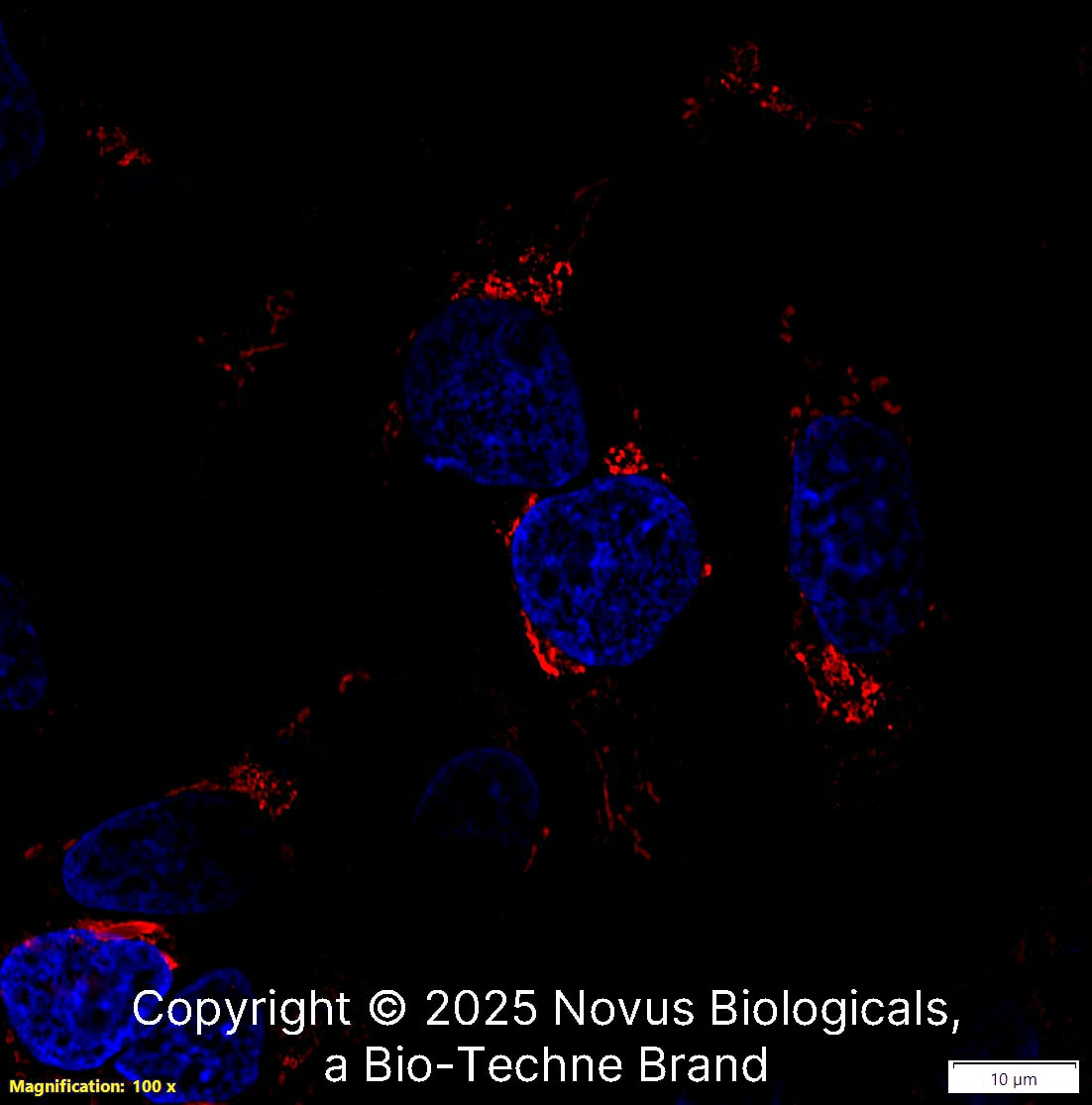 TGN46 Antibody - BSA Free