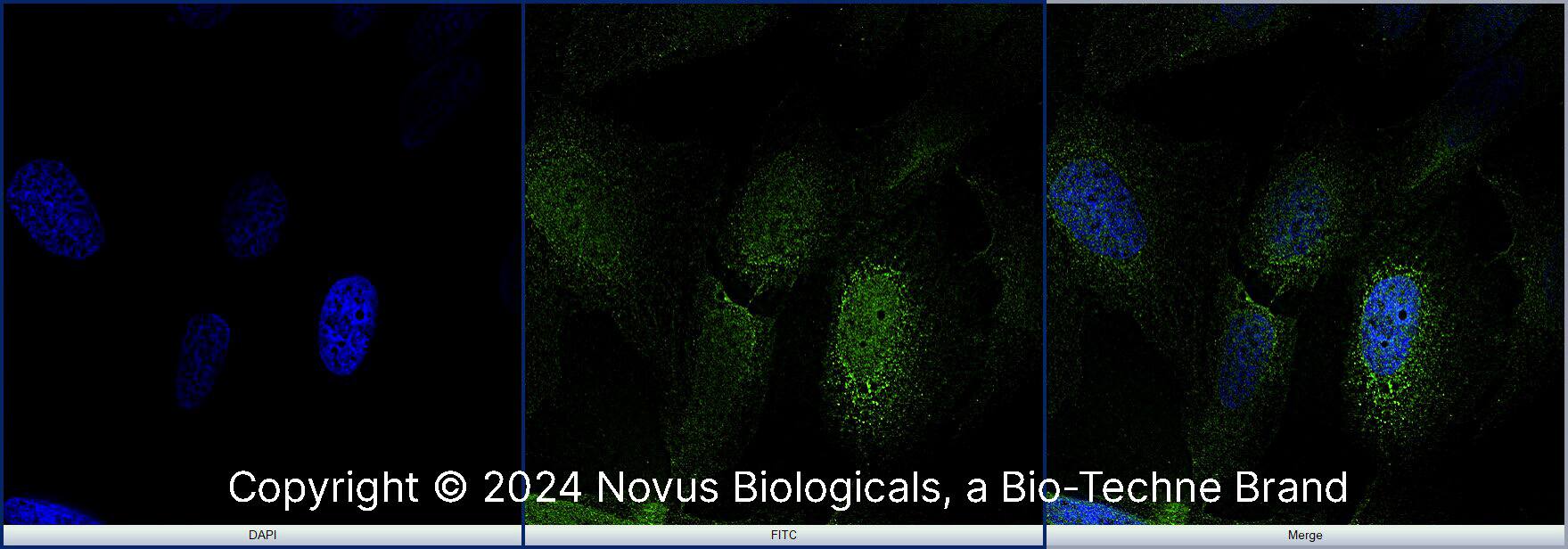 NKX6.1 Antibody - BSA Free