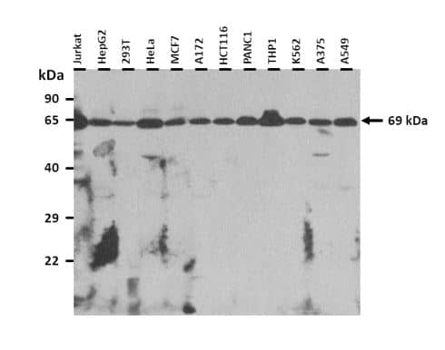 DMPK Antibody